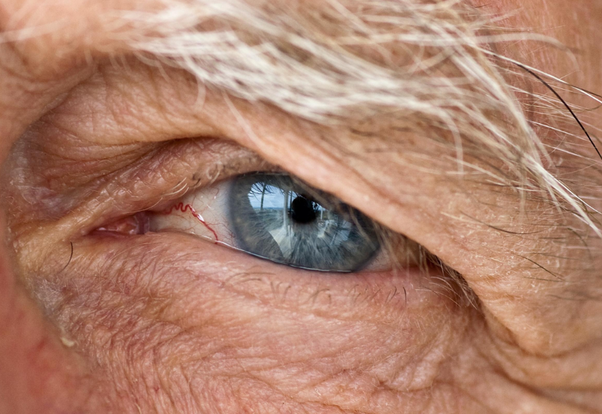 older man eye